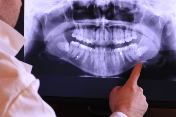 Best Broken or Cracked Tooth Emergency Dentist in Hamilton, TX