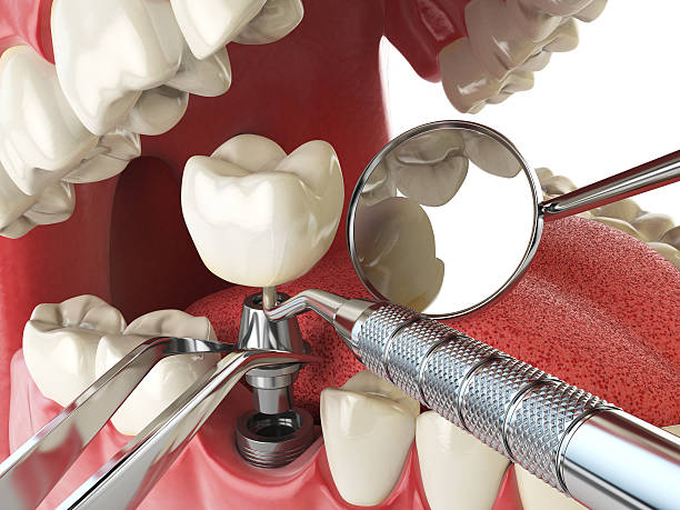 Best Emergency Dentist for Knocked-Out Tooth in Hamilton, TX